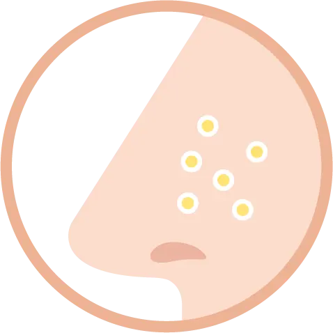 詰まり毛穴イメージ2