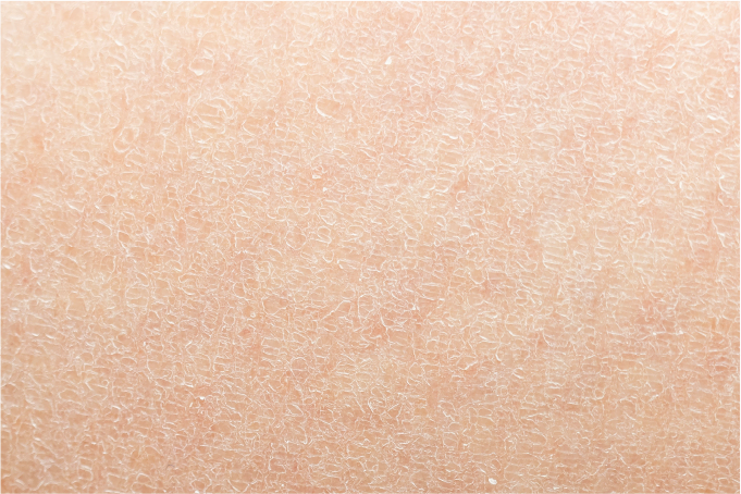 肌の画像1